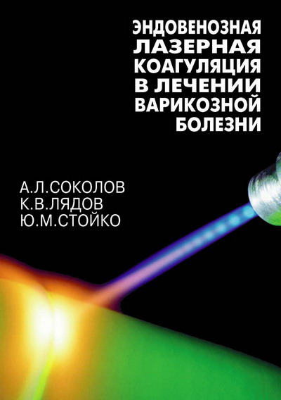Эндовенозная лазерная коагуляция в лечении варикозной болезни. Соколов А.Л., Лядов К.В., Стойко Ю.М.