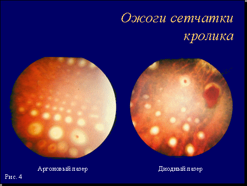 Рис. 4.