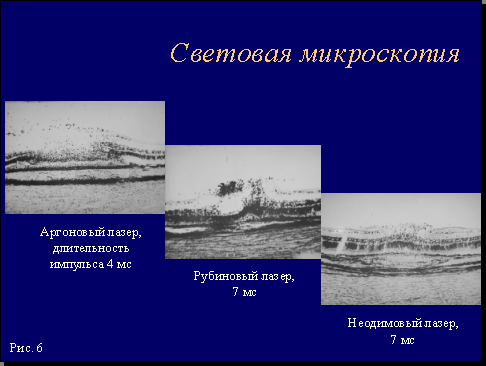 Рис. 6.